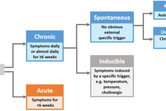 Patient Preferences in Chronic Urticaria Treatments