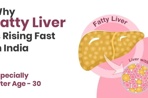 Indians at Higher Risk of Fatty Liver Disease